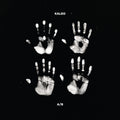 Kaleo - (PRESALE 6/19/26) A/B (IEX BLACK AND WHITE 2xVINYL) | Mint (M) Mint (M)-Classic Vinyl Record
